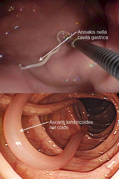 papilloma e parassiti