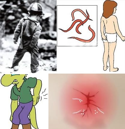 Medicine a incrinature anali